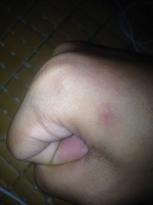 ������˪���ΰ�֢�� ����������������