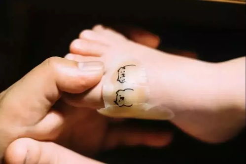 四种不是癌症的癌症 哪种癌不算癌 四种不是癌症的癌症 哪种癌不算癌