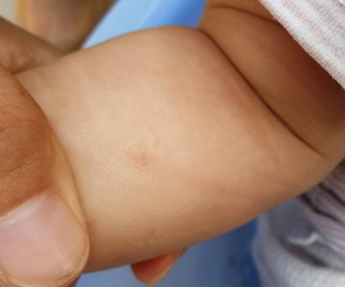 �������ǰ�֢������ �������ǰ�֢������ͼƬ