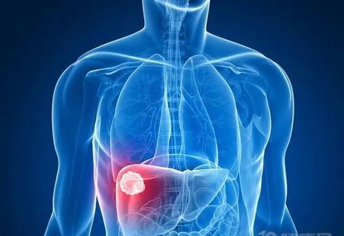 周杰伦大婚周杰伦大婚床垫 周杰伦大婚周杰伦大婚床垫