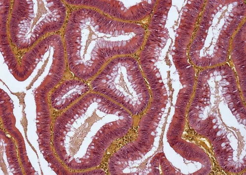 张震八极拳 张震八极拳冠军 张震八极拳 张震八极拳冠军