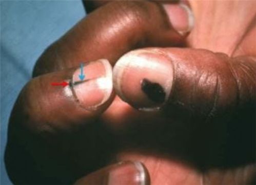 国外癌症妈妈 国外母亲得癌症的电影 国外癌症妈妈 国外母亲得癌症的电影