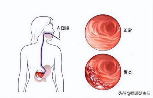 牛奶防止癌症 牛奶可以抗癌 牛奶防止癌症 牛奶可以抗癌