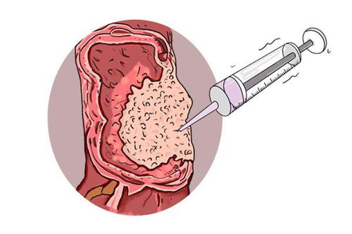 经常腹泻便秘是癌症吗 经常腹泻便秘是癌症吗