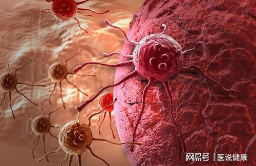 癌症预后疲劳 癌症疲劳能治好吗 癌症预后疲劳 癌症疲劳能治好吗