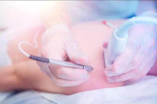 ��֢����һ��Լ�����Ӽ