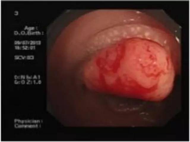 冯绍峰家产有一百亿吗 冯绍峰家产有一百亿吗