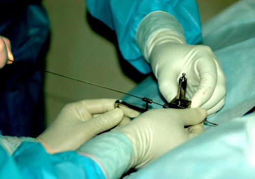 Į֮�����̰�֢ Į֮�����̶���Ǯһ��