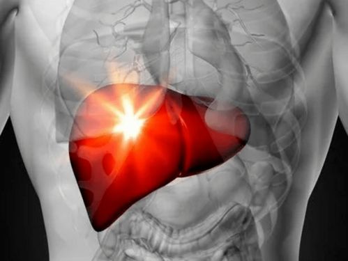 ���������׵ÿ�ǻ��֢