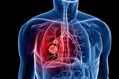 ��֢�߷��ܳ�������(��֢���������)