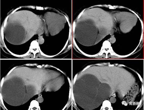 洋葱是不是可以预防癌症 洋葱是不是可以预防癌症