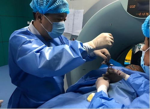 附睾硬化癌症 附睾癌变 附睾硬化癌症 附睾癌变