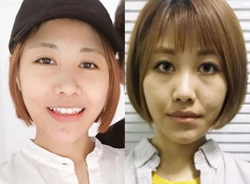 ������Ƥ��ð�֢��(������Ƥ��ʲô�ô� )