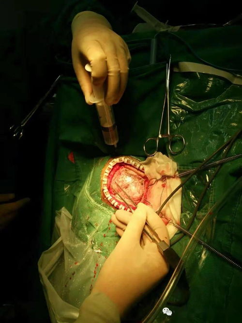 ����ҩ�������ְ�֢����