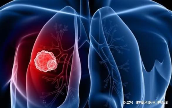 ���Ż���֢�����Լ���