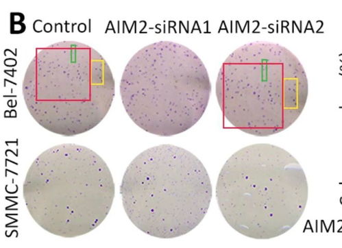 �������ּ����ǰ�֢��