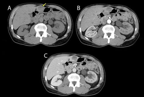 我爸癌症怎么去药房拿药 我爸癌症怎么去药房拿药