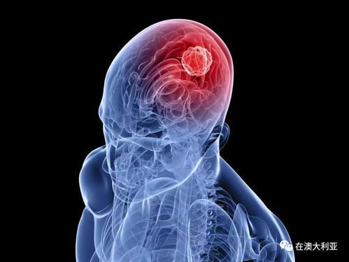 ���ŵð�֢ ���ŵ��˰�֢������