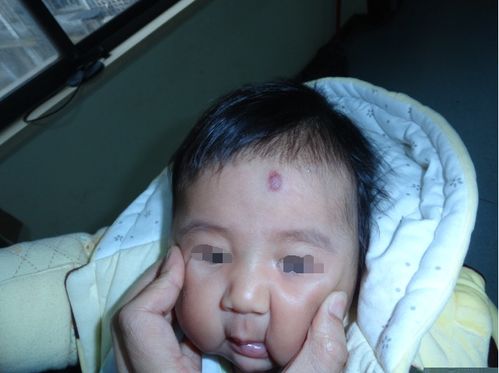 ��֢��д�� ��֢���Ӣ����д