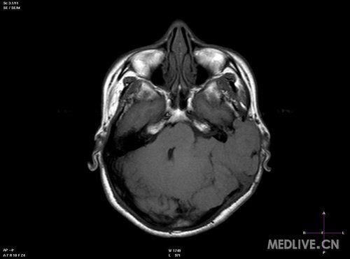 ����ʦ�����ư�֢ ��������ҽ