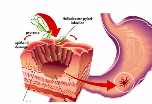 ����Ϣ������ǰ�֢��
