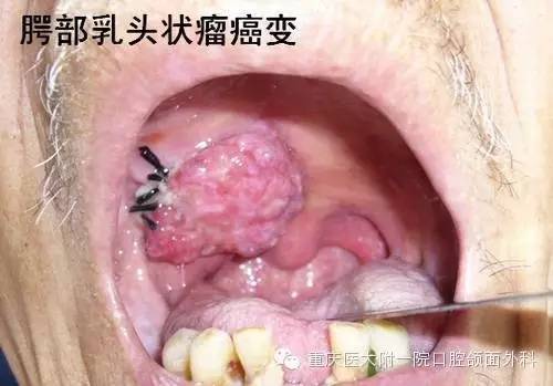 ��Щ��֢�����ȫ������