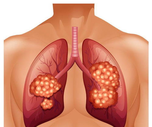 ��֢���Դ� ��֢���˲�������ʳ�� �ŵ���ϴп�����