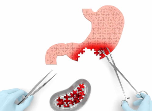 ʲôԭ���׵ü�״�ٰ�֢