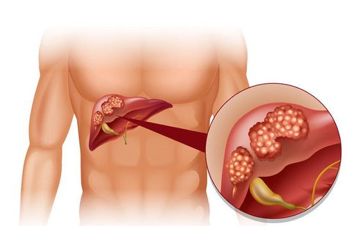 ��֢�����ϳ����Ϻò���