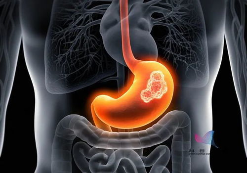 汤加真的没有得癌症的吗 汤加真的没有得癌症的吗