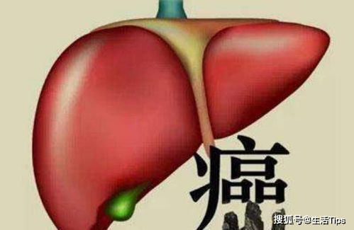 30分钟治疗癌症中药 治疗癌症的特效中药方 30分钟治疗癌症中药 治疗癌症的特效中药方