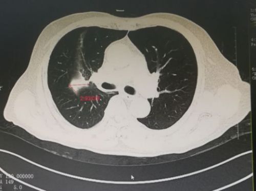 蒋雯丽和黄轩分手原因 蒋雯丽和黄轩分手原因