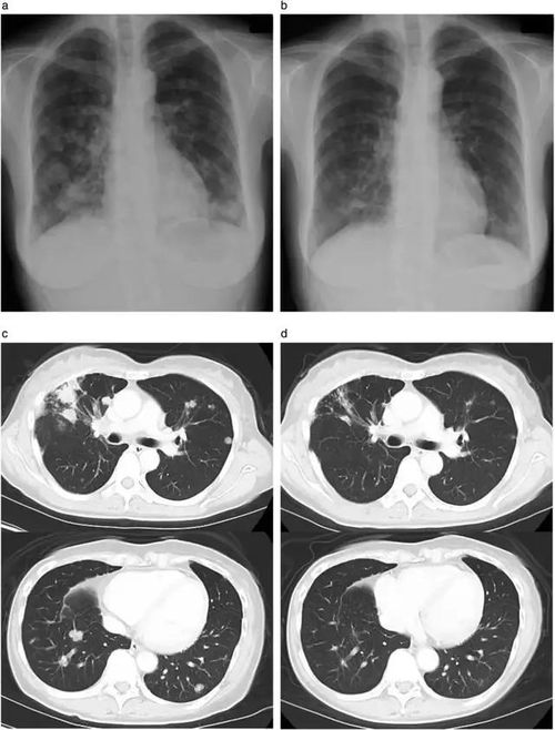 ����һ��������˰�֢