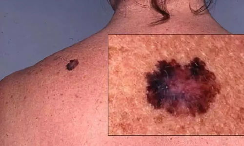 �ҷ���Ҷ����ǰ�֢��