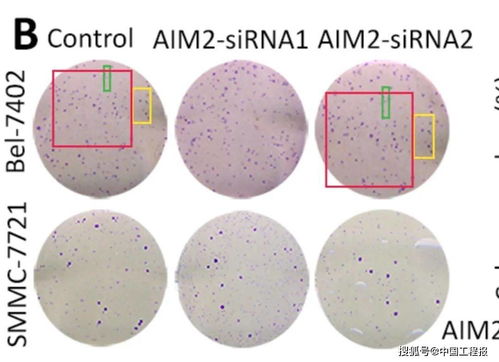量子共振癌症筛查价格表 量子共振癌症筛查价格表