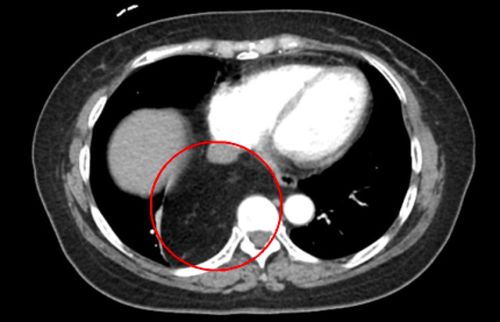 Ƶ�����ð�֢ �ϴ��û᲻���ǰ�