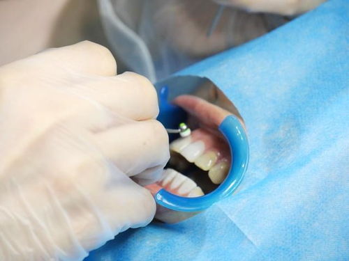 ���˰�֢�Ĳ����Գ�����