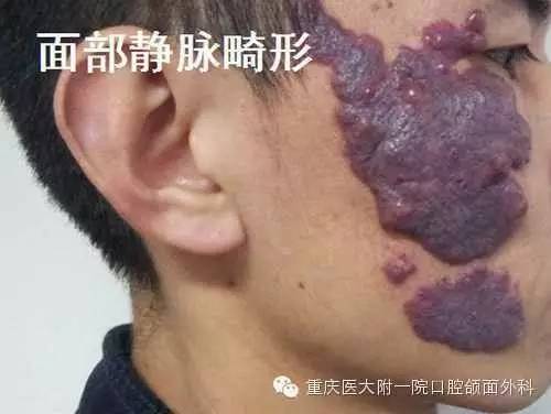 �ļ����˶�����Ԥ����֢