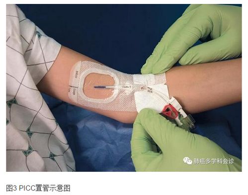 ���簩֢������������