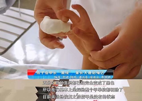 ��֢���϶��� ��֢����ʶ���ǲ��ǿ���ѽ