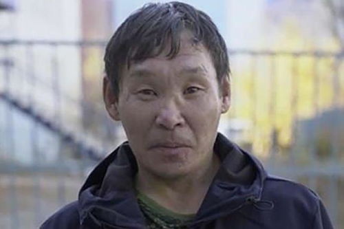 ��֢�����������Ⱦ����