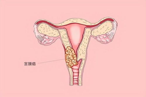 奥迪a3导航 奥迪a3导航投屏方法 奥迪a3导航 奥迪a3导航投屏方法