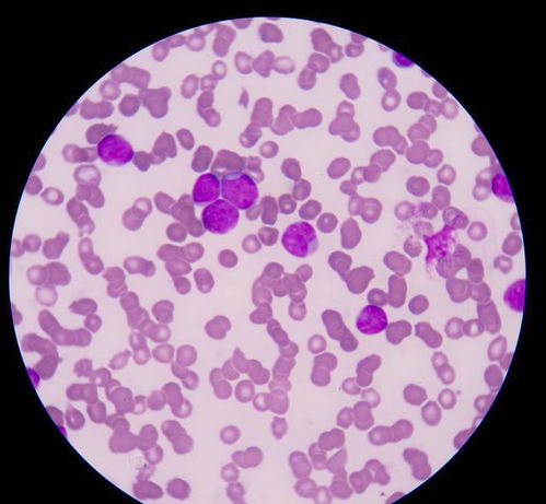 һ����ҩ�ΰ�֢���� ��֢������ҩ�����ɹ�����