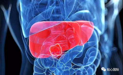 ������ư�֢���ҽҩ���޹�˾