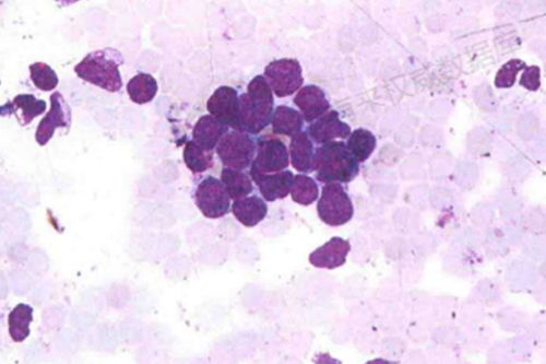 �Ϲ�����֢ϱ����ʲô