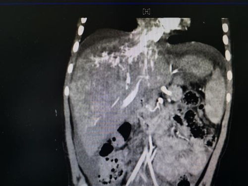 关咏荷主演过的电视剧 关咏荷主演过的电视剧
