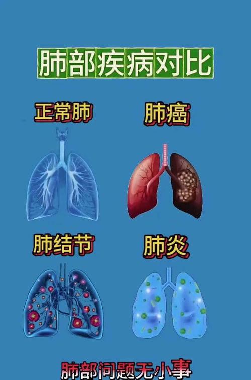 ��֢���ڷ��պ���ô��