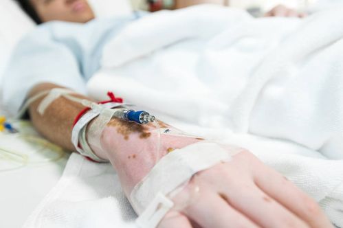 ����ǰ�����ܱ䰩֢��Ů