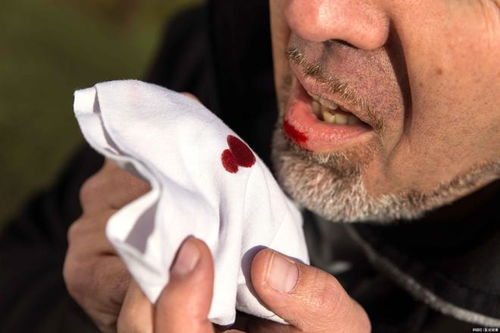 ��֢�ÿ��� ��֢������