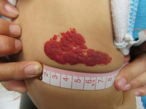 阿尔巴尼亚针 阿尔巴尼亚针的织法视频 阿尔巴尼亚针 阿尔巴尼亚针的织法视频